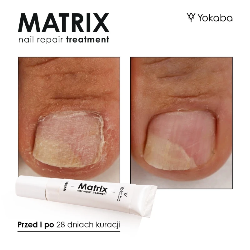 Matrix Tratamiento reparador de uñas Yokaba 15 ml - Imagen 3