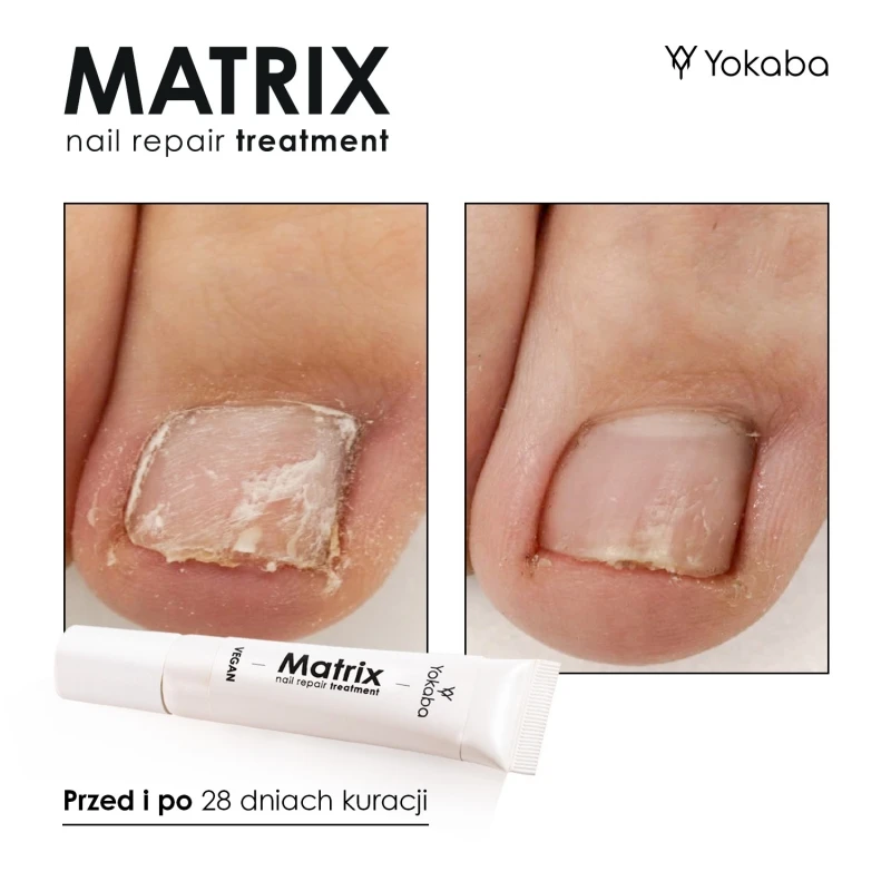 Matrix Tratamiento reparador de uñas Yokaba 15 ml
